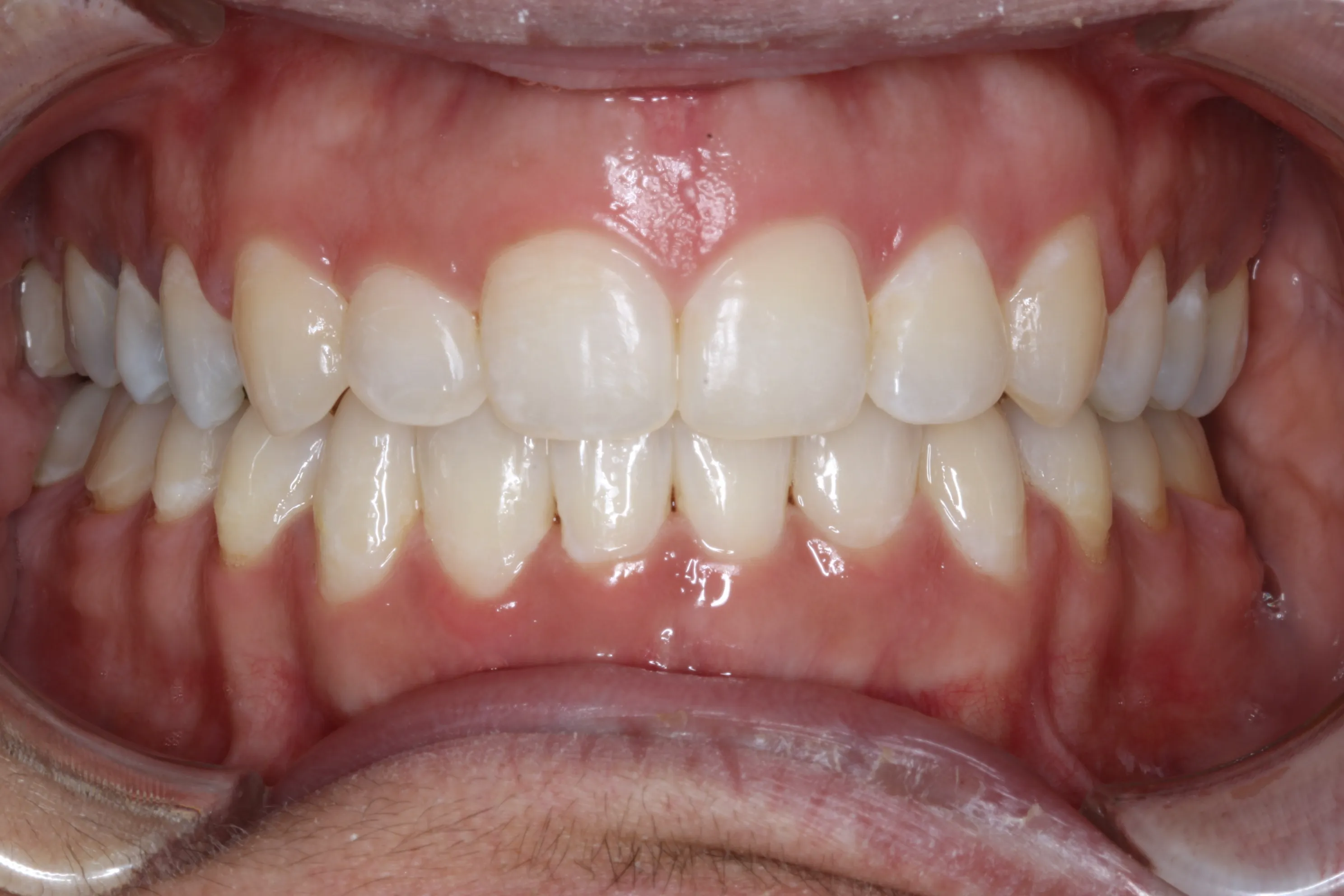 smile-gallery gallery